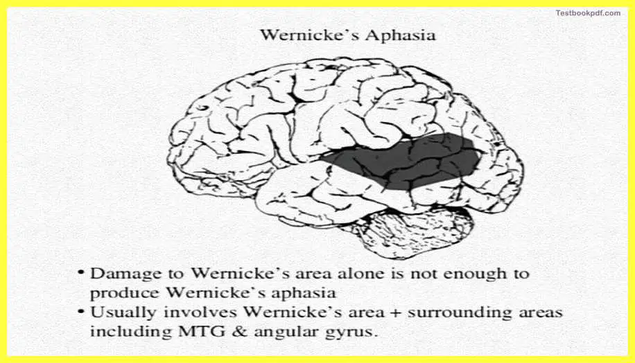 Wernicke’s Aphasia-The-Cerebral-Cortex-Psychology-Theory-Images-Pdf-Download