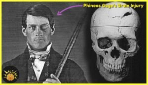 Phineas-Gage-s-Brain-Injury-testbookpdf