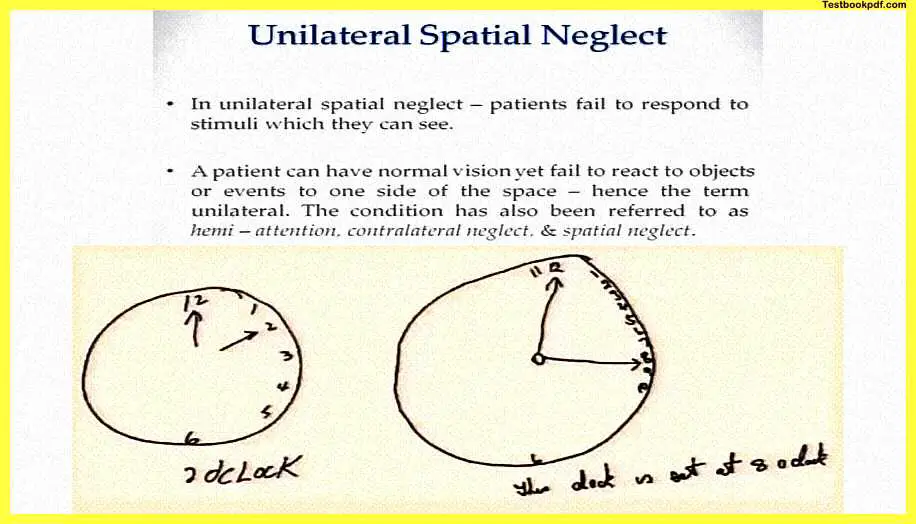 Disorders-of-Perception-and-Attention-Pdf